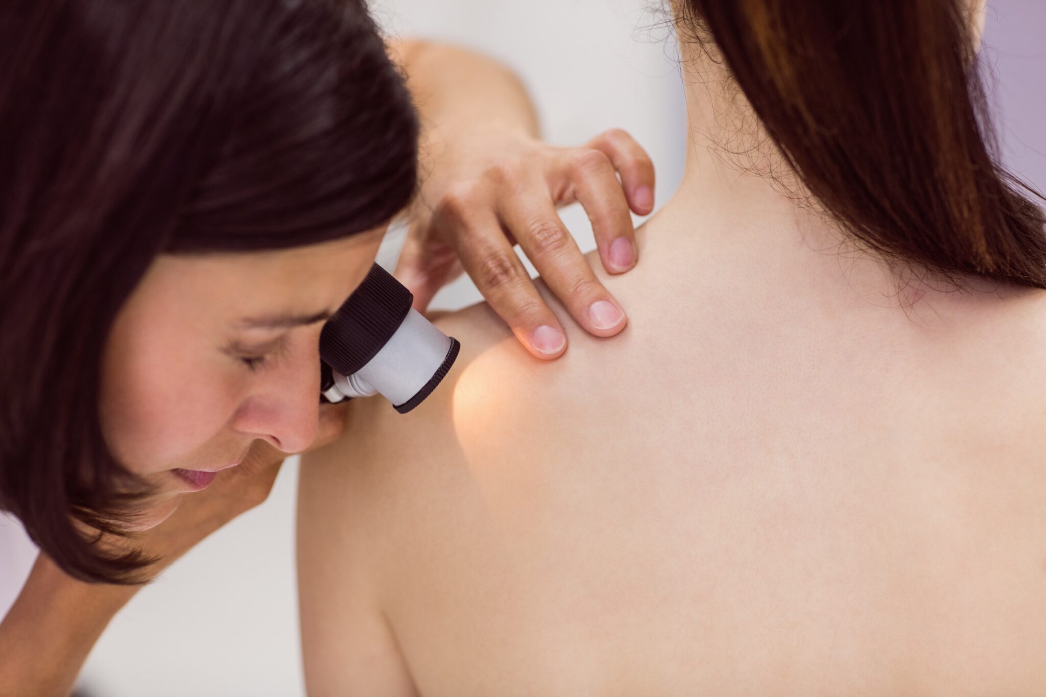 How Lasers Can Help Treat Birthmarks and Vascular Lesions